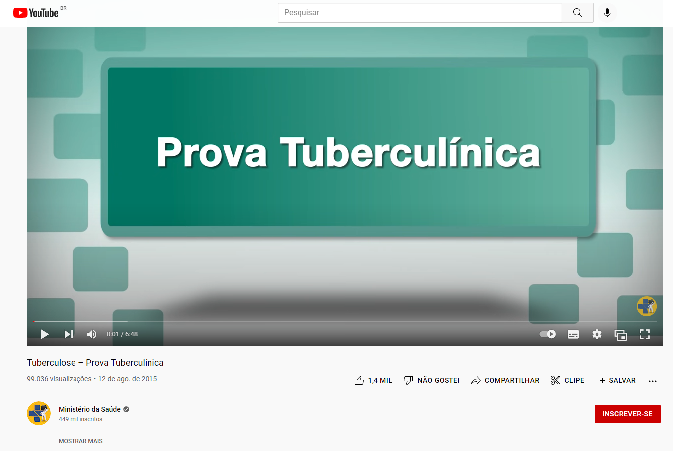 Tuberculose – Prova Tuberculínica (YouTube) 