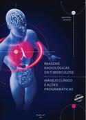Atlas Radiológico - Imagens radiológicas da Tuberculose / Manejo clínico e ações pragmáticas